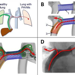 flow pvr urology.